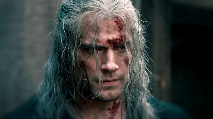 Henry Cavill in The Witcher, with cuts and scrapes on his face.